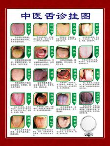 span class=h>中医/span>舌诊 span class=h>挂图/span span