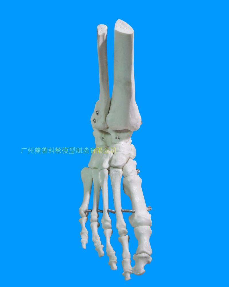 1:1脚关节模型 脚部骨骼模型足关节 足骨 脚骨模型 脚部解剖结构