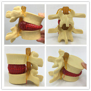 腰椎     腰椎间1盘突出演示模型 人体脊柱 脊椎骨病理演示模型