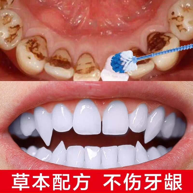 【不白包退】牙齿美白神器速效去黄牙小苏打洗牙粉抖音款去烟牙渍