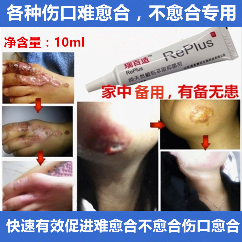促进各种难愈合不愈合伤口愈合褥疮膏去腐生肌特效快速瑞百适正品