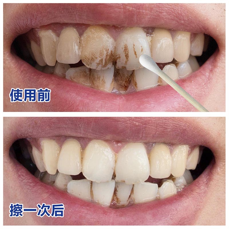 牙斑净速效牙齿美白洁牙液洗牙粉强效去烟牙黄牙黑牙一擦白洁牙素
