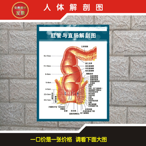 《肛管与直肠解剖图》医学宣传挂图人体器官解剖图医院布置宣传画