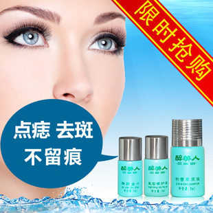 点痣药水无痕祛痣去痣膏祛斑去黑痣除痣灵美容金水正品雀斑点斑水