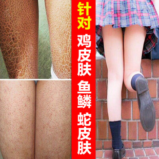 去除鸡皮肤简单又有效(有什么办法可以祛除鸡皮肤)