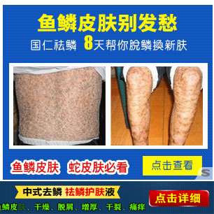 鸡皮肤鱼鳞形(鱼鳞鸡皮肤的原因)
